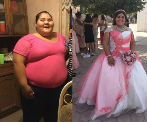 Joven de Sinaloa baja 90 kilos para festejar sus XV años
