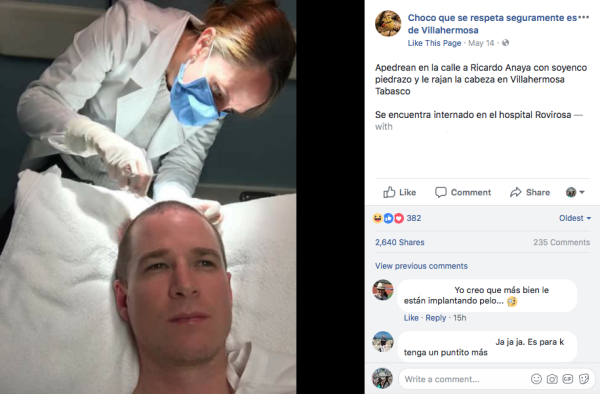 VERIFICADO 2018: Ni apedrearon a Ricardo Anaya ni está hospitalizado en Villahermosa, Tabasco