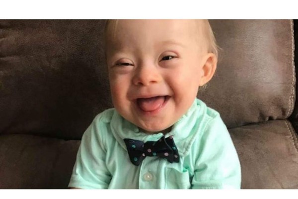 Gerber elige a un bebé con síndrome de Down para su nueva imagen