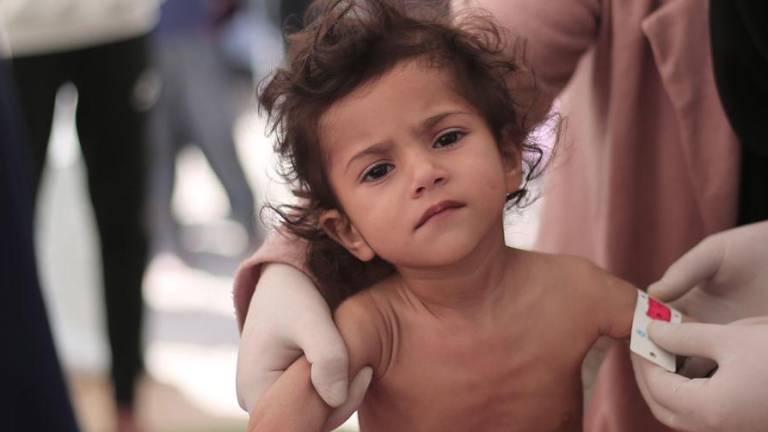 Muchos niños de Gaza muestran signos de desnutrición aguda grave y pérdida drástica de peso.