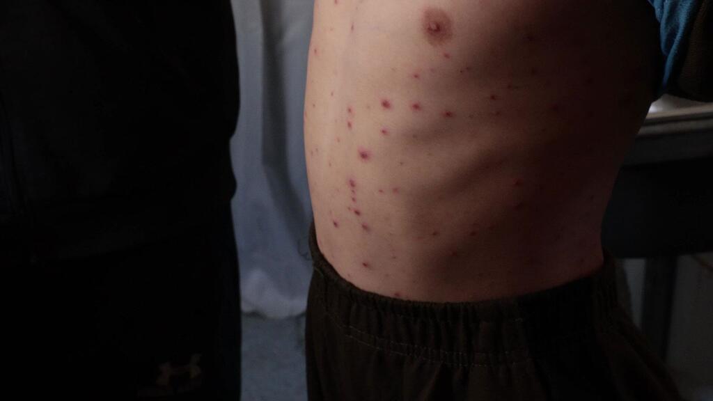 $!Un niño con una enfermedad de la piel que afecta a su cuerpo acude a la clínica de dermatología.