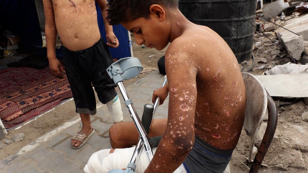 $!El niño palestino Zain Al-Anqar resultó herido por la explosión de un sospechoso resto de guerra en Gaza.