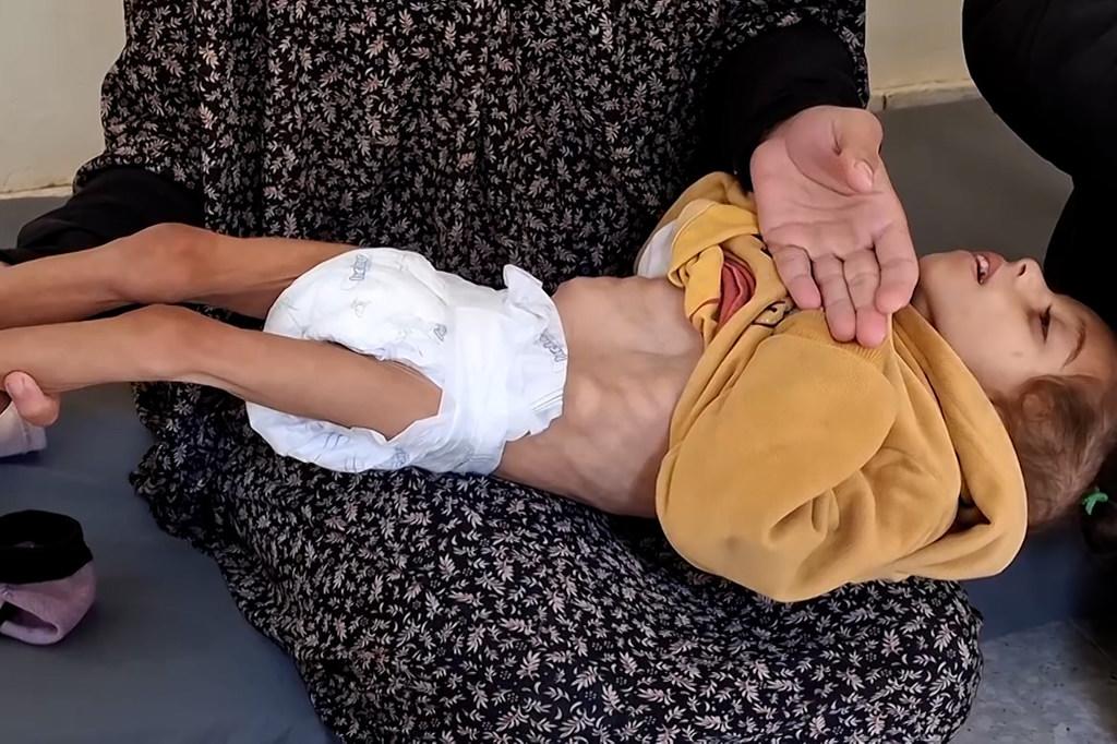 $!Misk Al-Madhoun, un niño gazatí que sufre hambre y desnutrición.