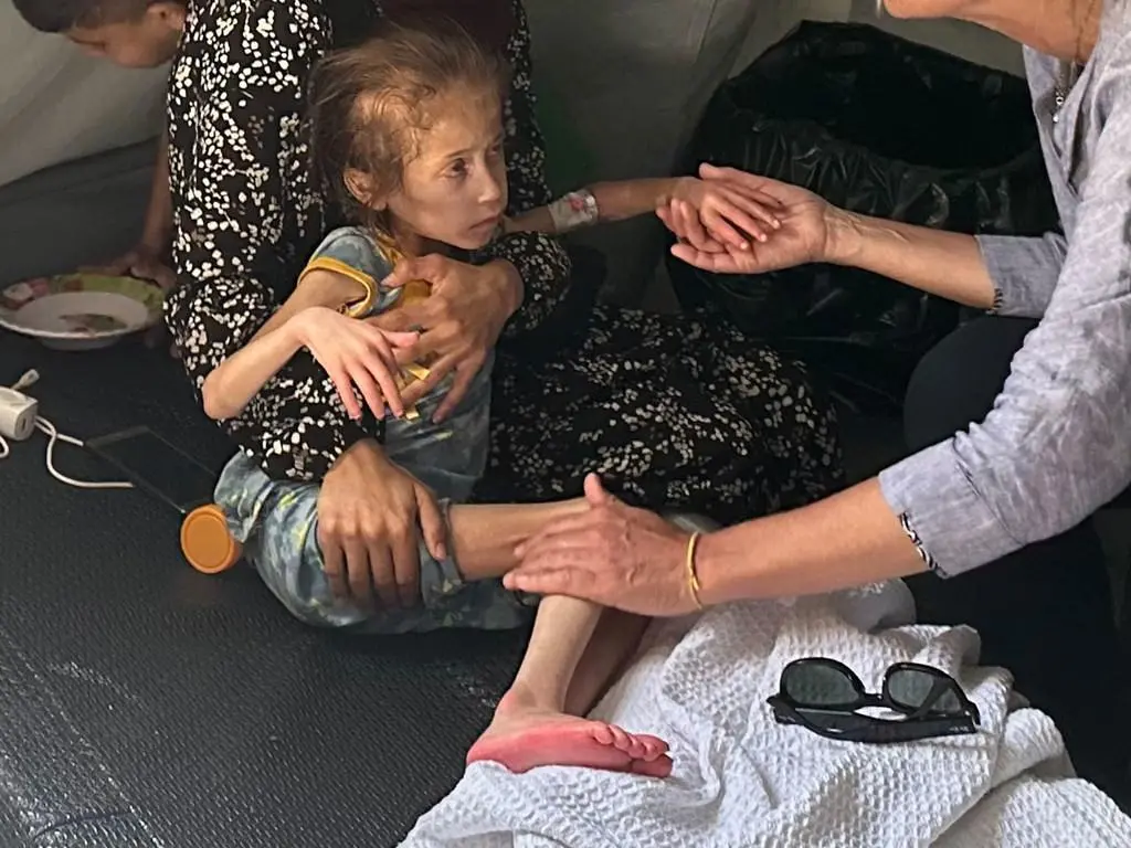 $!La hambruna y la malnutrición asolaron y continuán asolando a la población de Gaza después de que Israel haya impedido la entrada a gran escala de ayuda humanitaria durante la guerra y el alto el fuego.