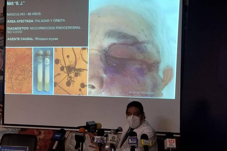 Hospital Civil de Culiacán confirma 8 pacientes recientes de hongo negro; 5 fallecieron