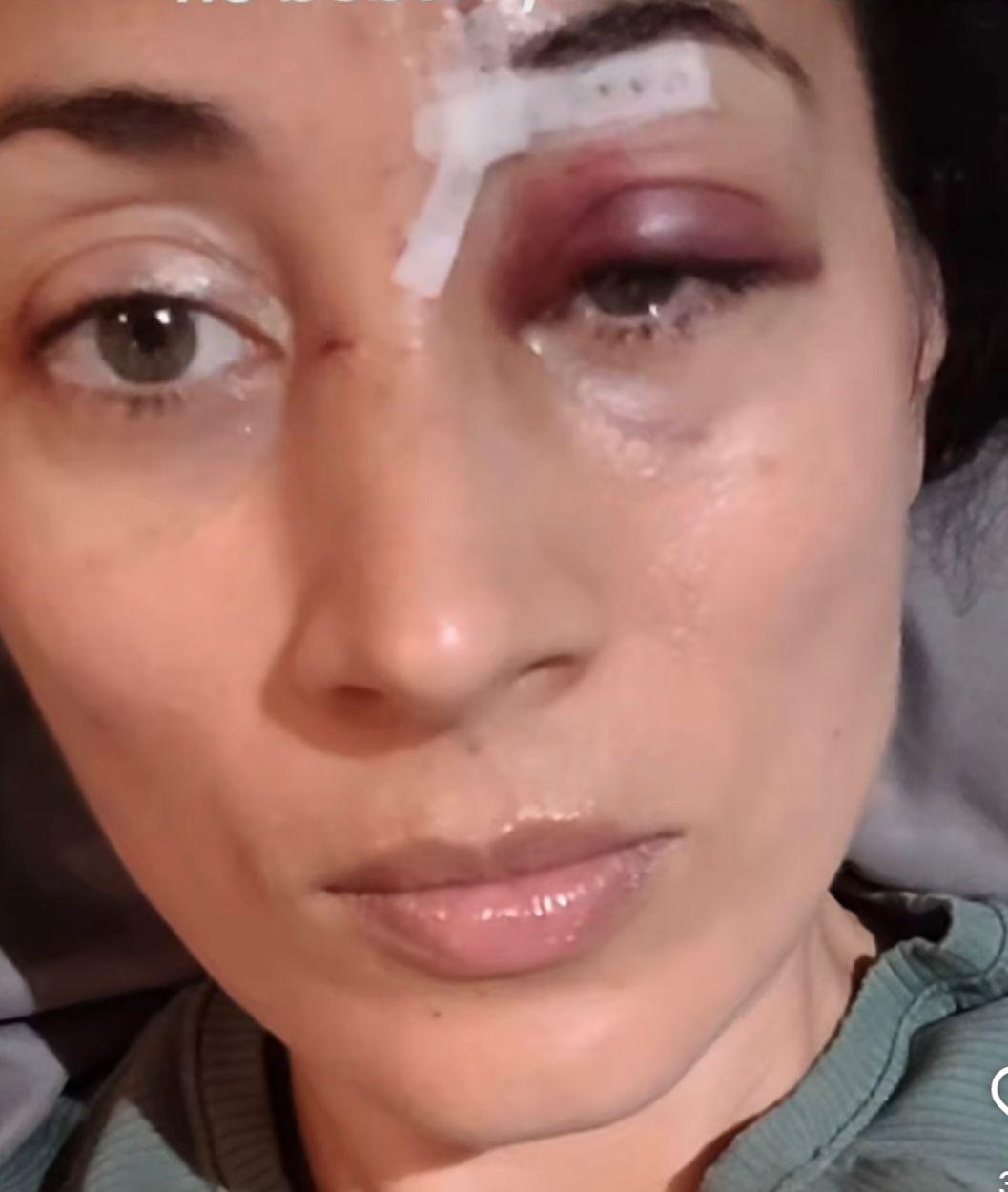 $!Sufre patinadora accidente al ser arrollada por scooter eléctrico en ciclovía del malecón de Mazatlán