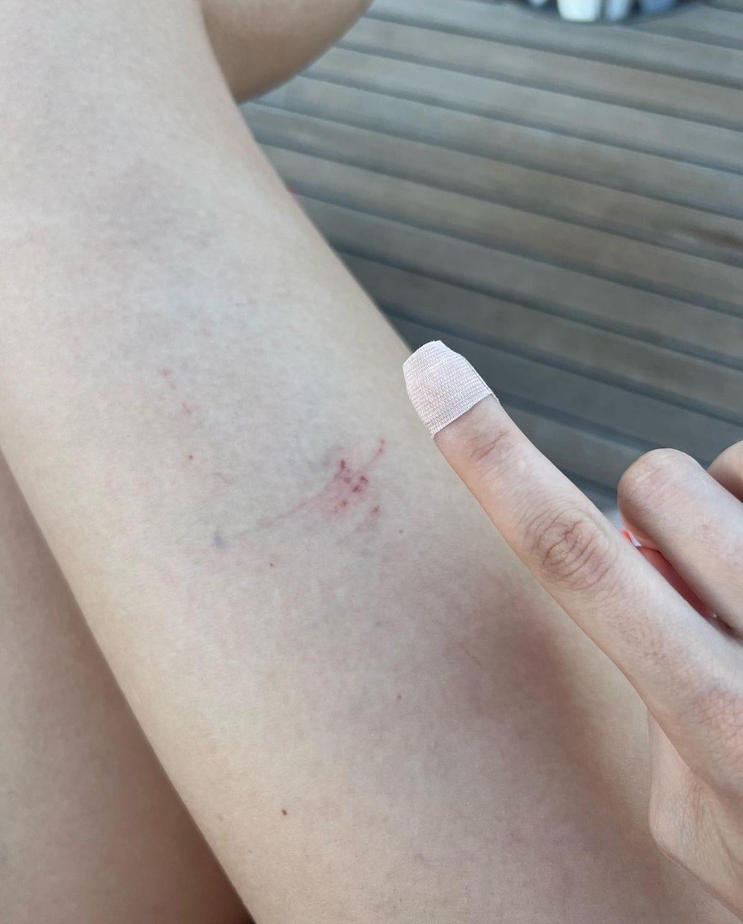 $!Belinda sufre un ‘accidente’ en sus vacaciones, mientras escalaba junto a Jared Leto