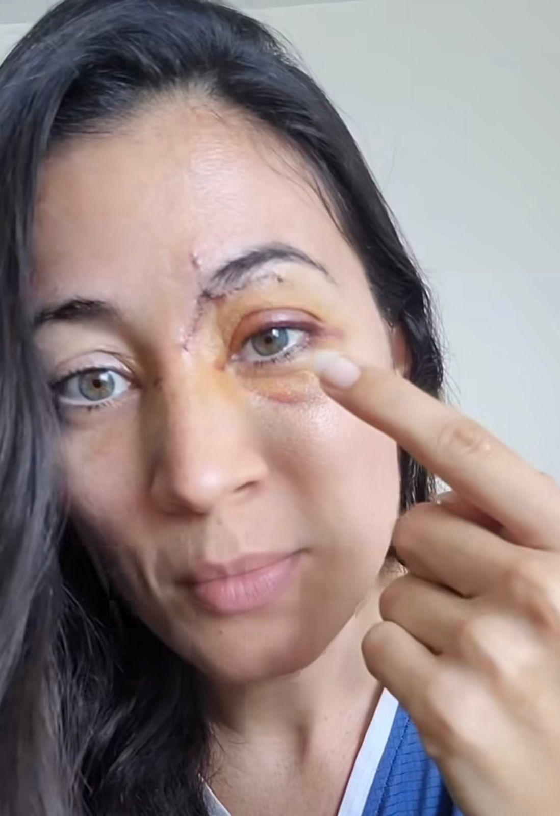 $!Sufre patinadora accidente al ser arrollada por scooter eléctrico en ciclovía del malecón de Mazatlán