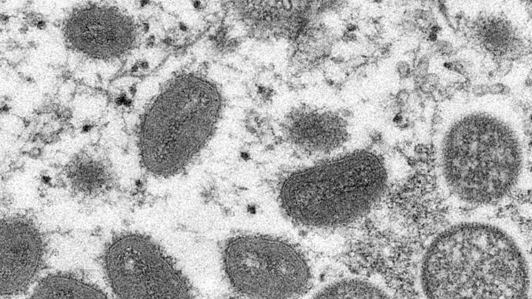 Virus que propaga la viruela símica.