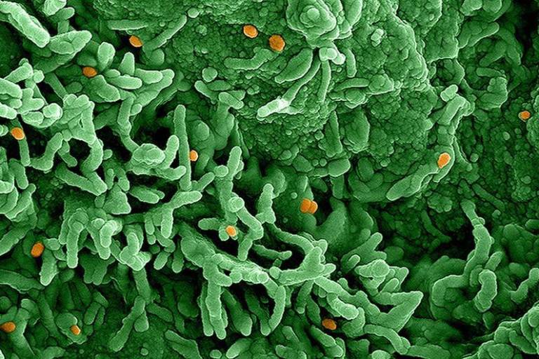 Declara la OMS a la mpox como emergencia de salud pública internacional