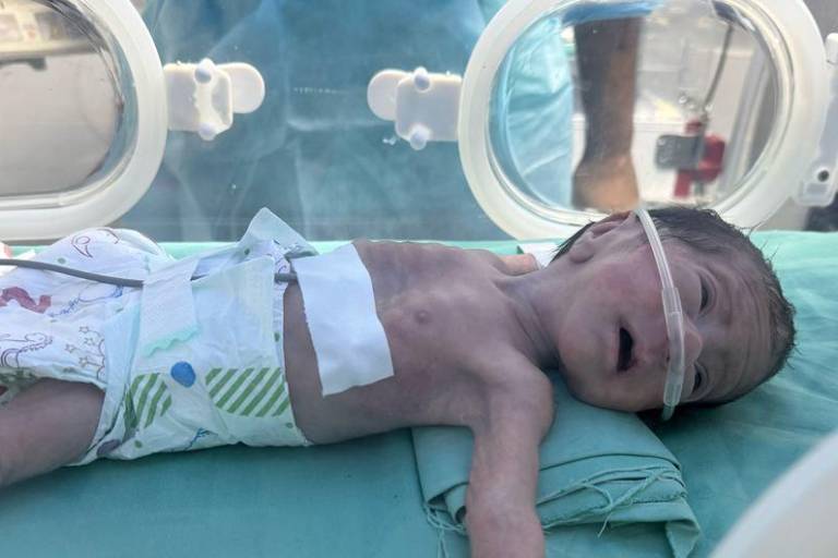 La hambruna masiva en Gaza es fabricada y deliberada: UNRWA