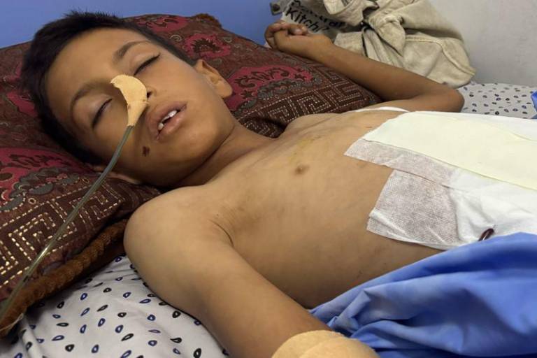 Los hospitales en Gaza están desbordados de heridos y las enfermedades raras empieza a surgir