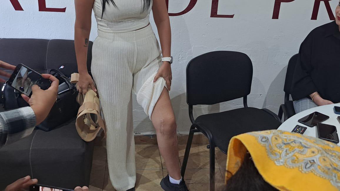 $!Presentan mujeres policías queja ante CEDH porque Gobierno de Mazatlán se niega a jubilarlas y pensionarlas por invalidez