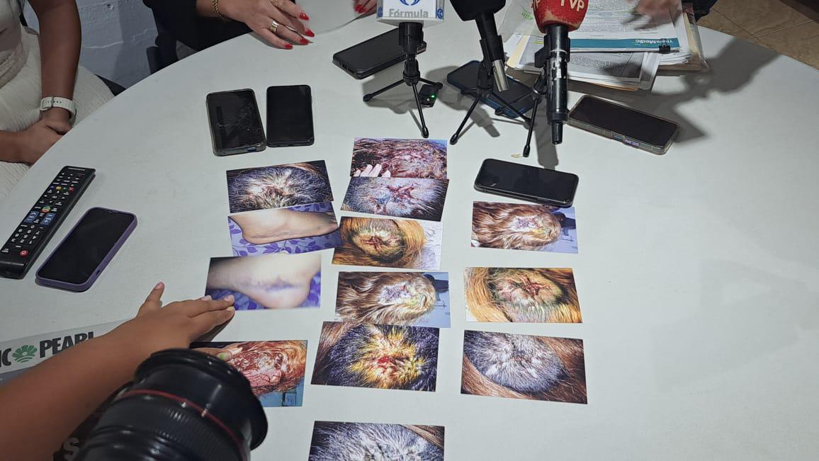 $!Presentan mujeres policías queja ante CEDH porque Gobierno de Mazatlán se niega a jubilarlas y pensionarlas por invalidez