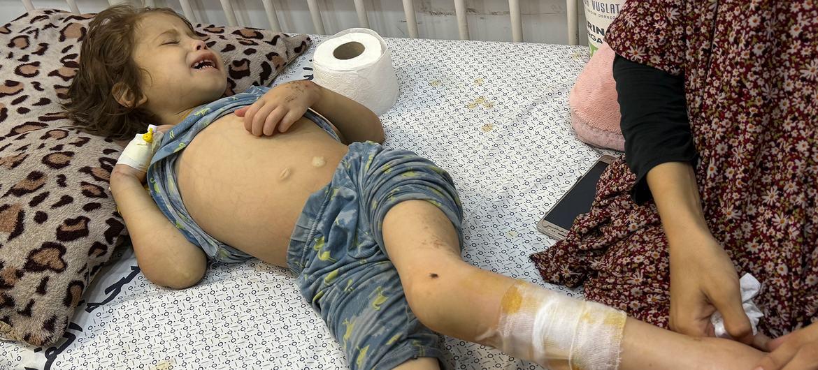 $!El hambre y una ola de calor azotan Gaza, mientras siguen los obstáculos de Israel a la ayuda humanitaria