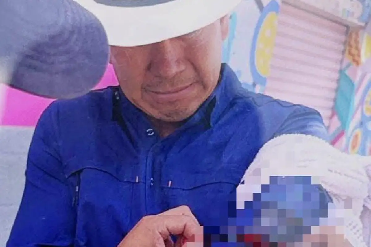 $!César Figueroa resultó herido en un brazo.