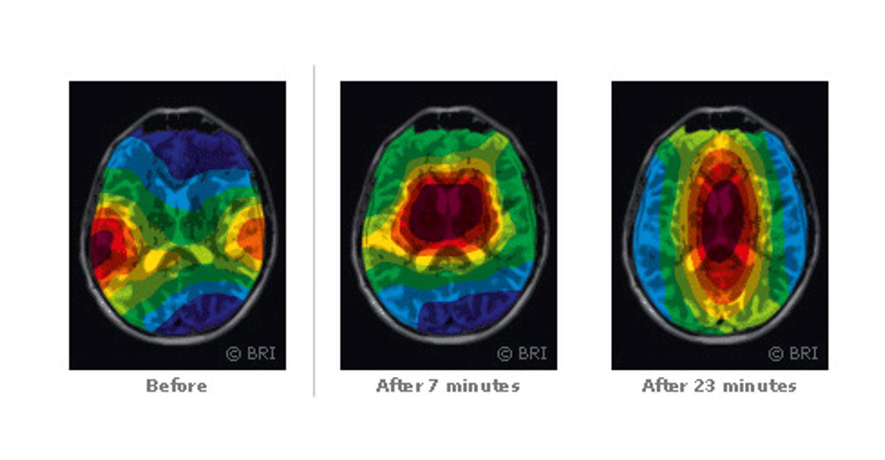 $!En esta foto ve cómo se activa y cambia el cerebro al iniciar y después de meditar.