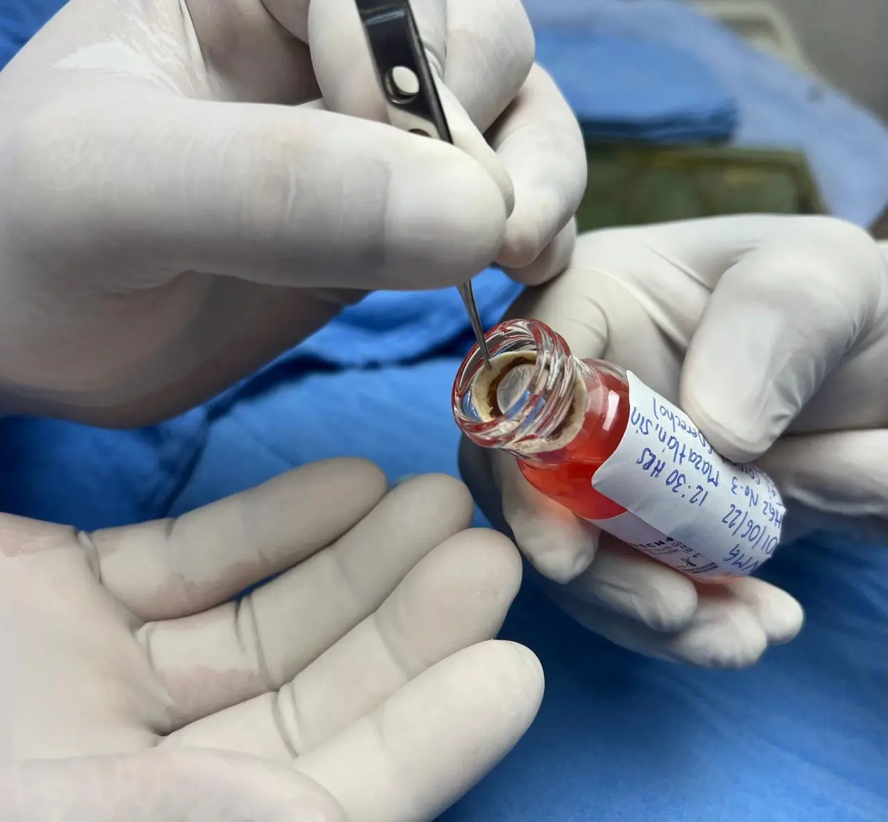 $!Aumenta IMSS Sinaloa en más de 150% productividad en donación de órganos