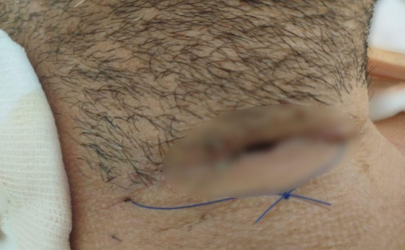 $!Denuncian presunta negligencia médica en hospital del IMSS en Mazatlán