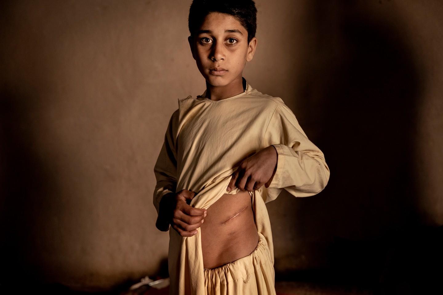 $!El precio de la paz en Afganistán del fotógrafo danés Mads Nissen para Politiken.