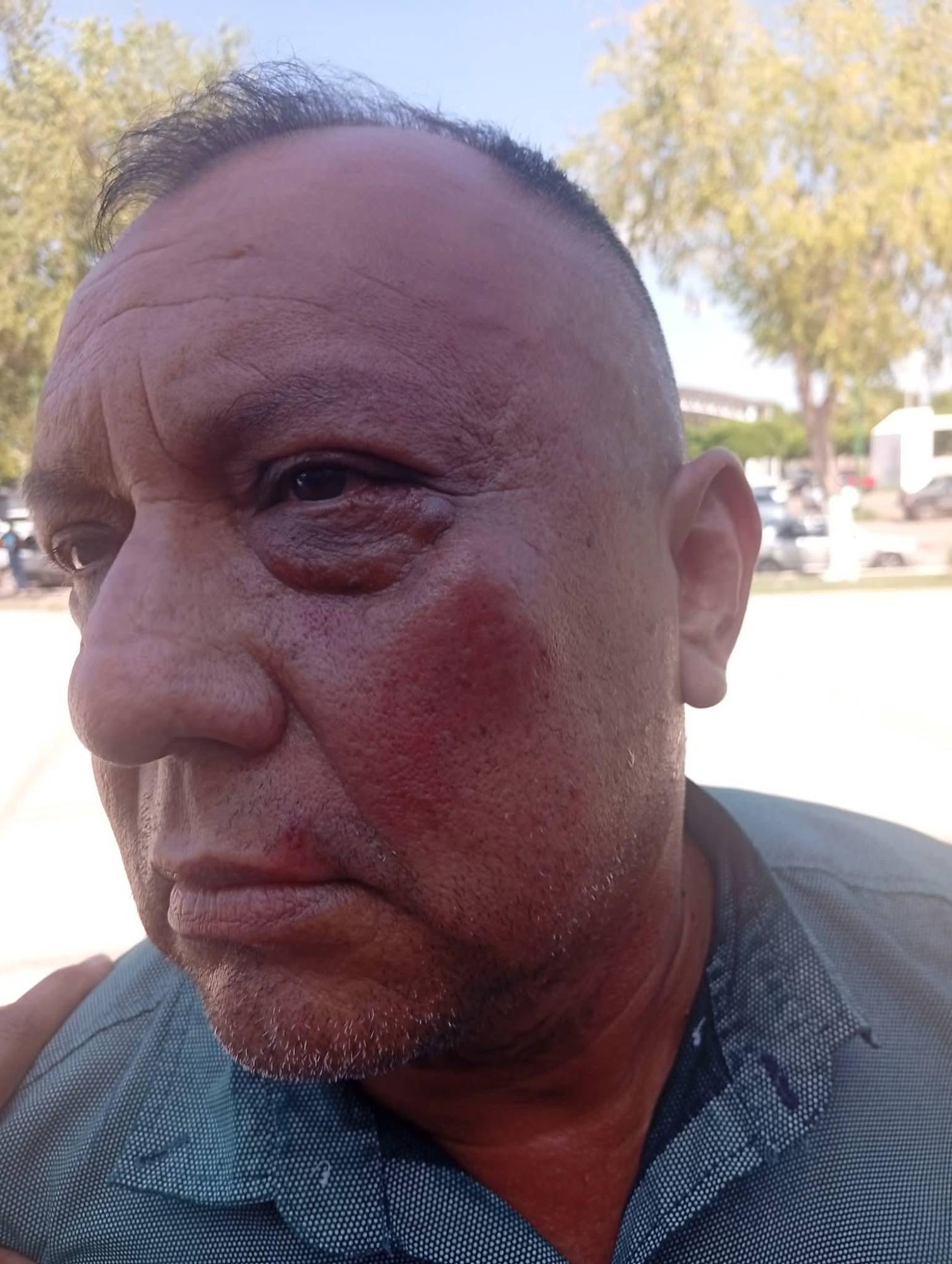 $!Periodista en Angostura es golpeado por líder de policías jubilados