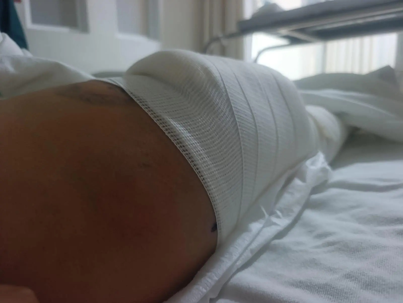 $!Heridos en ataque armado en Escuinapa denuncian falta de apoyo para continuar su recuperación