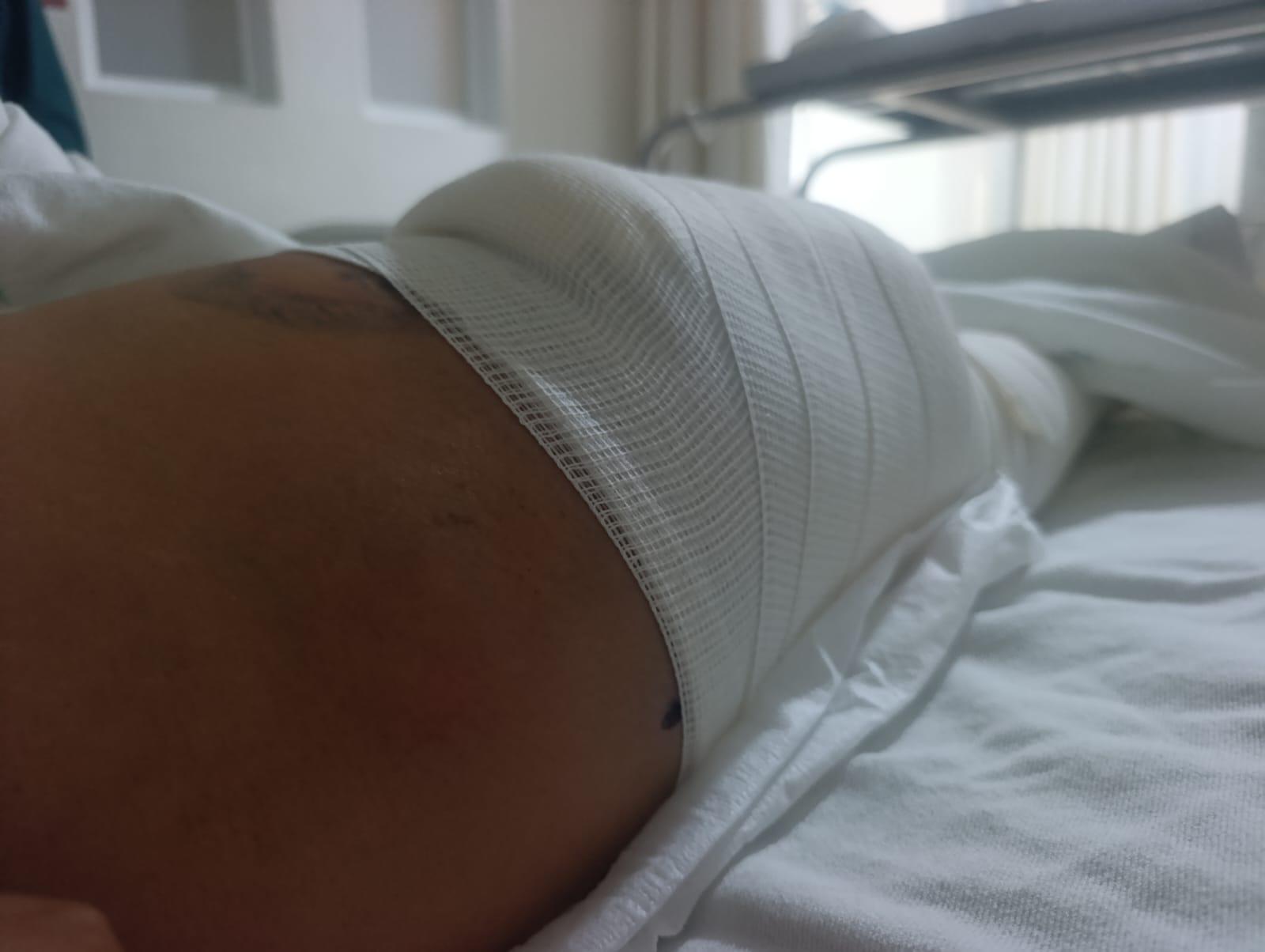 $!Heridos en ataque armado en Escuinapa denuncian falta de apoyo para continuar su recuperación
