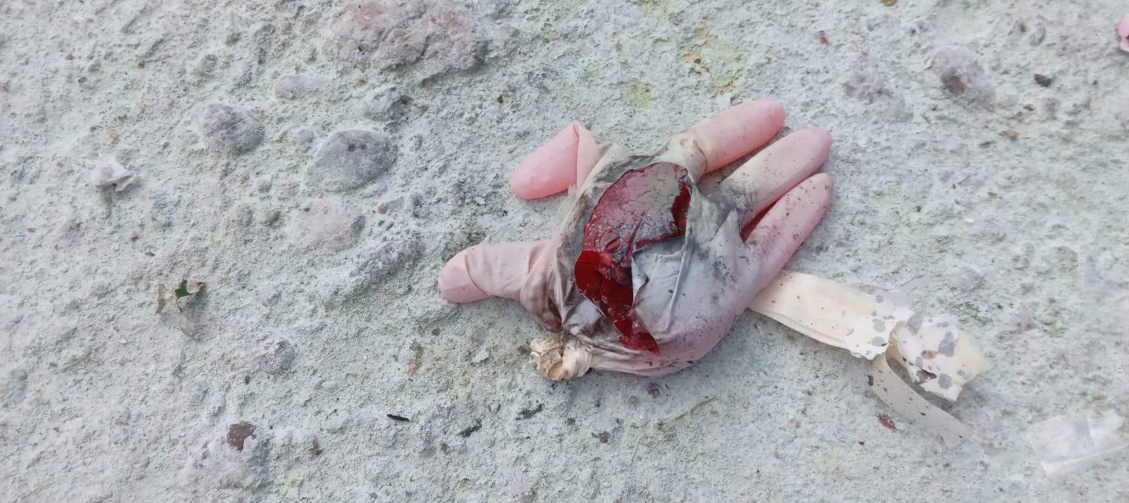 $!Relanzan campaña antipirotecnia en Culiacán y muestran daños por explosivos