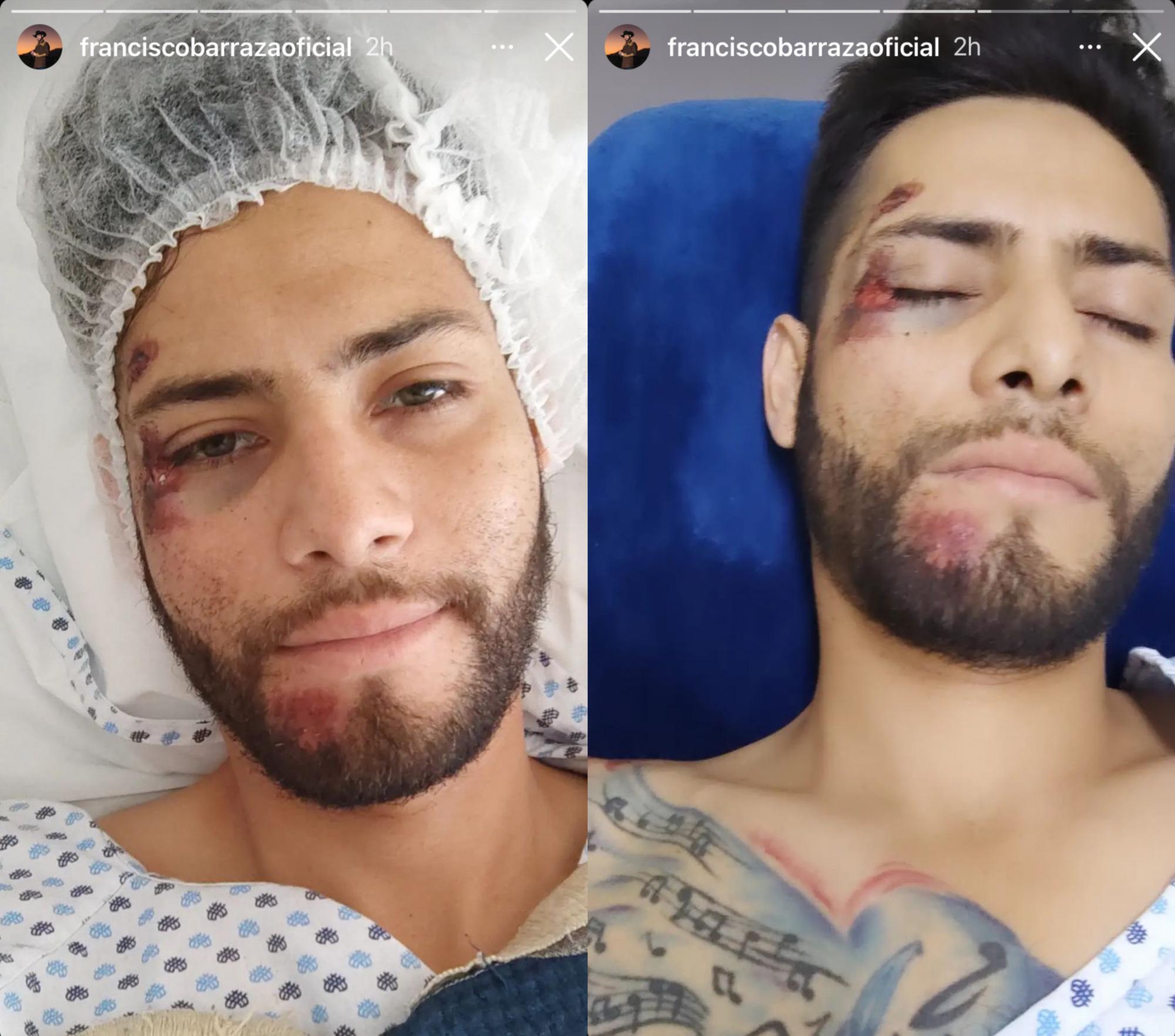 $!Francisco, hijo de Pancho Barraza, sufre accidente automovilístico