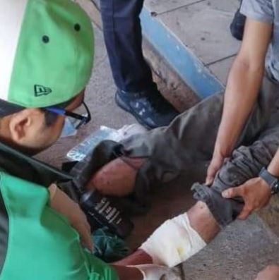 Resultan lesionados dos trabajadores tras explosión de un tambo metálico en Mazatlán