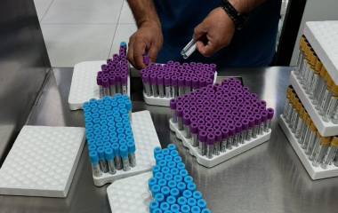 En el Hospital Regional Número 1 del IMSS en Culiacán procesan hasta 14 mil estudios de laboratorio.