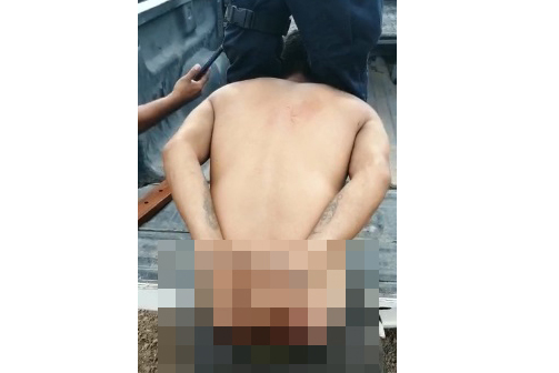 Inicia CEDH investigación sobre posible tortura a detenido por la policía de Escuinapa