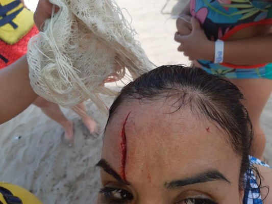 Turistas chocan cabezas en la Isla de la Piedra y una termina lesionada