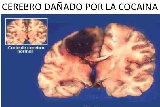 La Neurogénesis: Crear nuevas neuronas