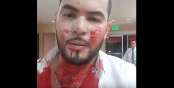 Ex concursante de 'La Voz México' transmite video tras ser baleado