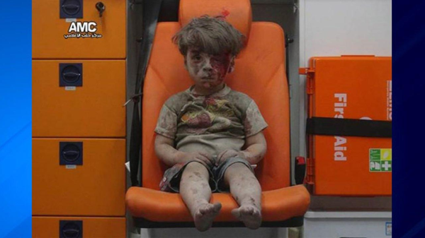 La FOTO de Omran Daqneesh, un niño sirio de 5 años, conmueve al mundo