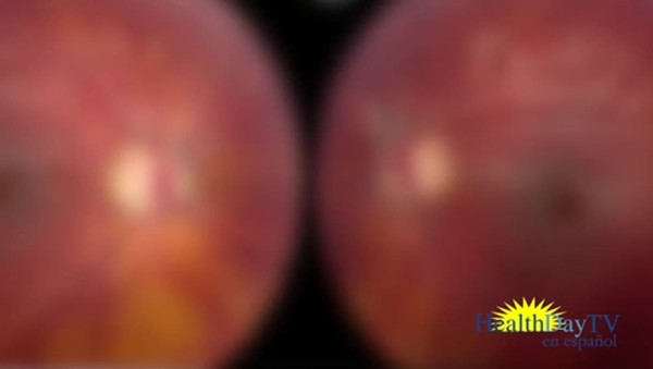 Los apuntadores laser no son juguetes