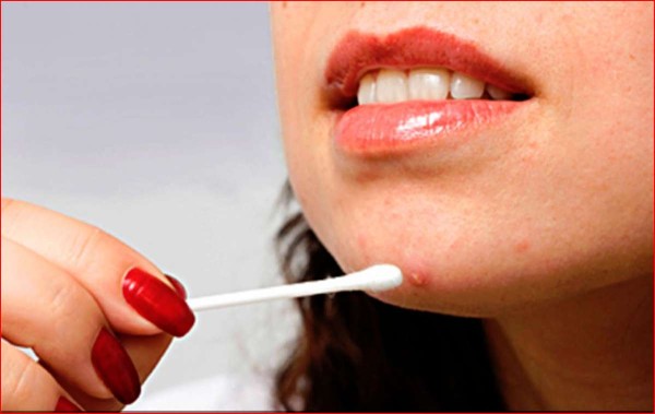 Recetas para luchar contra el acné