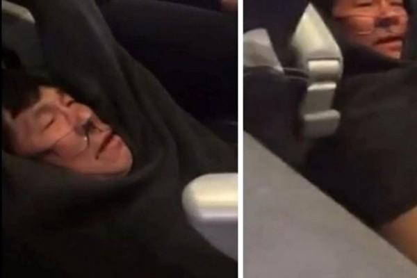 Pasajero arrastrado en un vuelo de United Airlines perdió dos dientes: Abogado