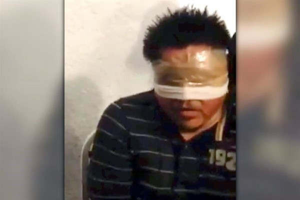 CNDH niega encubrir tortura de detenido por Ayotzinapa; ONU-DH pide sancionar a responsables