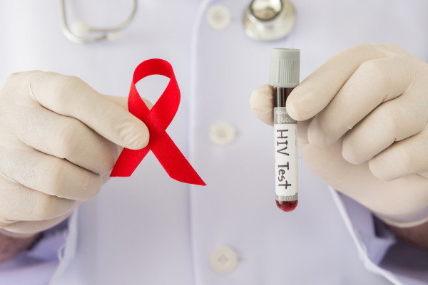 El VIH, un importante problema mundial de salud pública: OMS