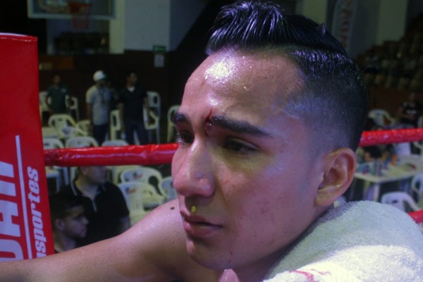 El mochiteco Andrés Olivas sufre una herida en el rostro.