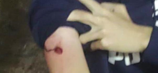 Joven recibe un impacto de bala cuando viajaba en un camión de Culiacán