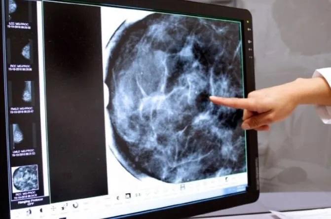 Confirman primera muerte por meningitis en Tamaulipas; hay 24 casos en la entidad