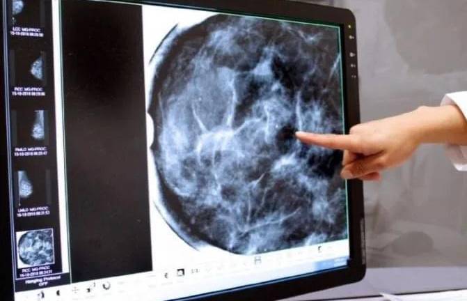 Hasta el momento suman 24 casos de esta enfermedad en Tamaulipas, de los cuales, seis permanecen internados.