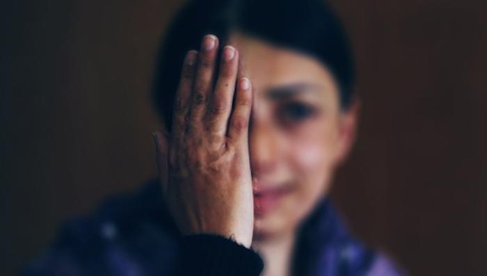 $!En México, lesionar a mujeres con ácido no es delito autónomo a pesar de las graves secuelas que padecen, de por vida, las sobrevivientes. T