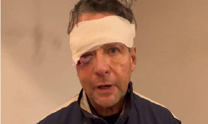 Sufre Alfredo Adame fracturas faciales y lesiones en un ojo, tras golpiza que le dieron