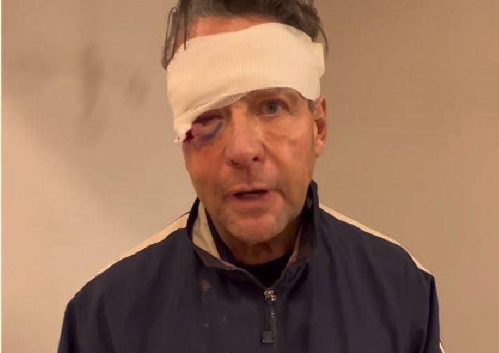 Sufre Alfredo Adame fracturas faciales y lesiones en un ojo, tras golpiza que le dieron