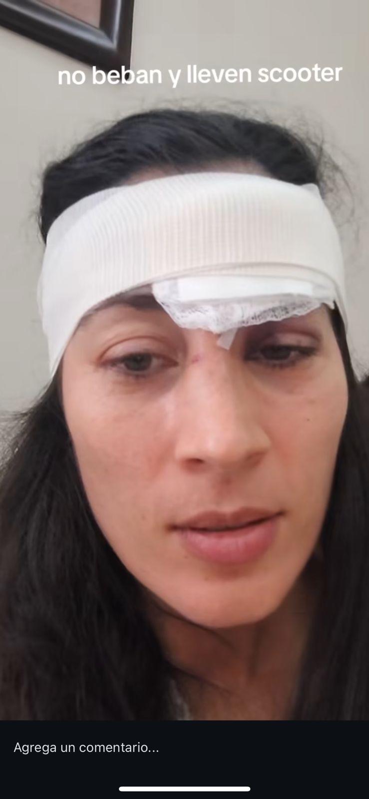 $!Sufre patinadora accidente al ser arrollada por scooter eléctrico en ciclovía del malecón de Mazatlán