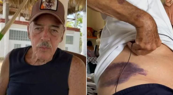 $!Andrés García sufre aparatosa caída que lo mantiene en cama